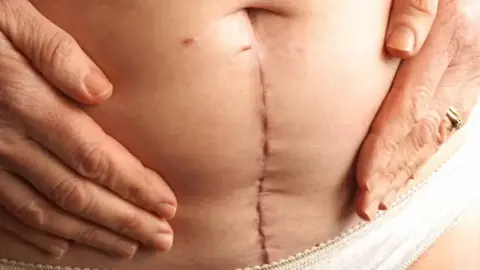 Abdominal Cerrahi Sonrası Rehabilitasyon