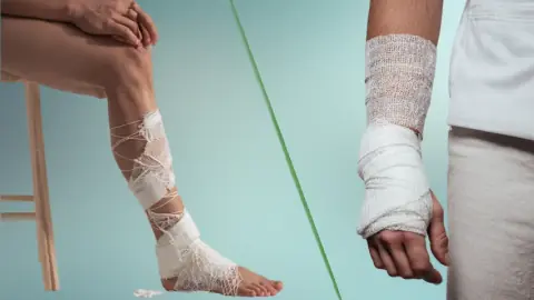 Kırık Sonrası Rehabilitasyon